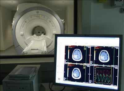 Fuente: EFE/El mal de Alzheimer es una enfermedad neurol�gica que en general afecta a personas mayores de 65 a�os y su s�ntoma principal es la p�rdida progresiva de la memoria 
